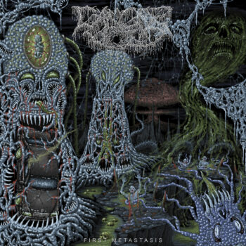 Cancer Void - First Metastasis MLP
